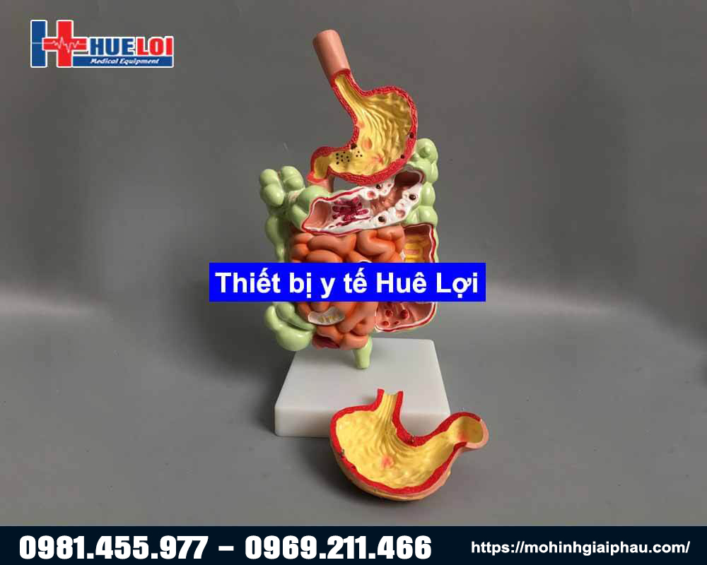 Mô hình giải phẫu hệ tiêu hóa 3D